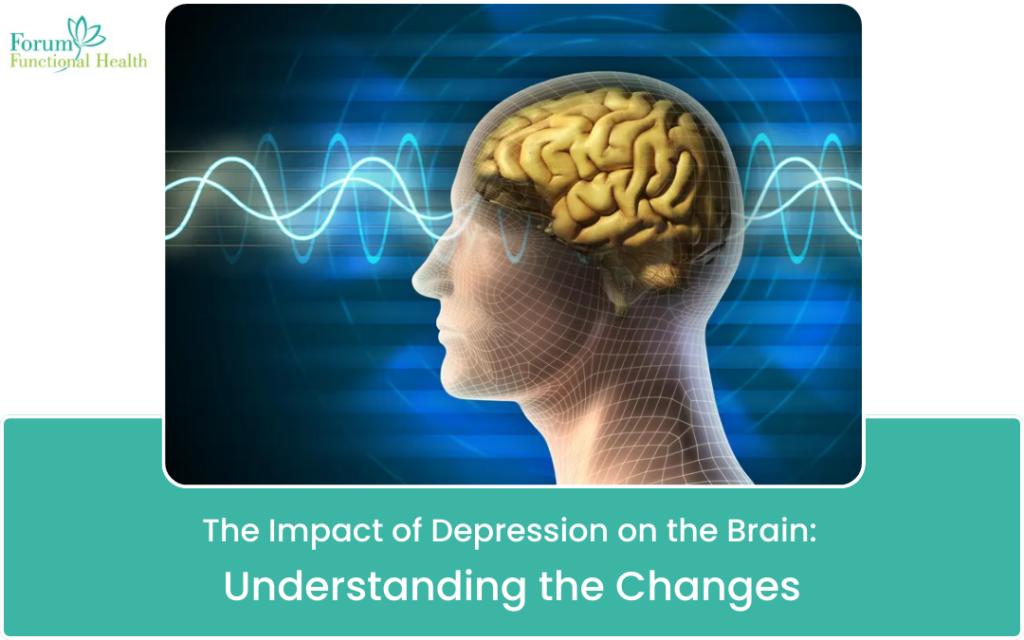 The Impact of Depression on the Brain