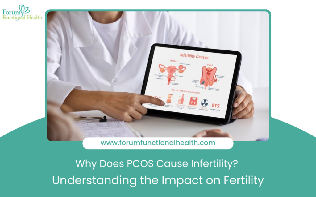 PCOS and fertility
